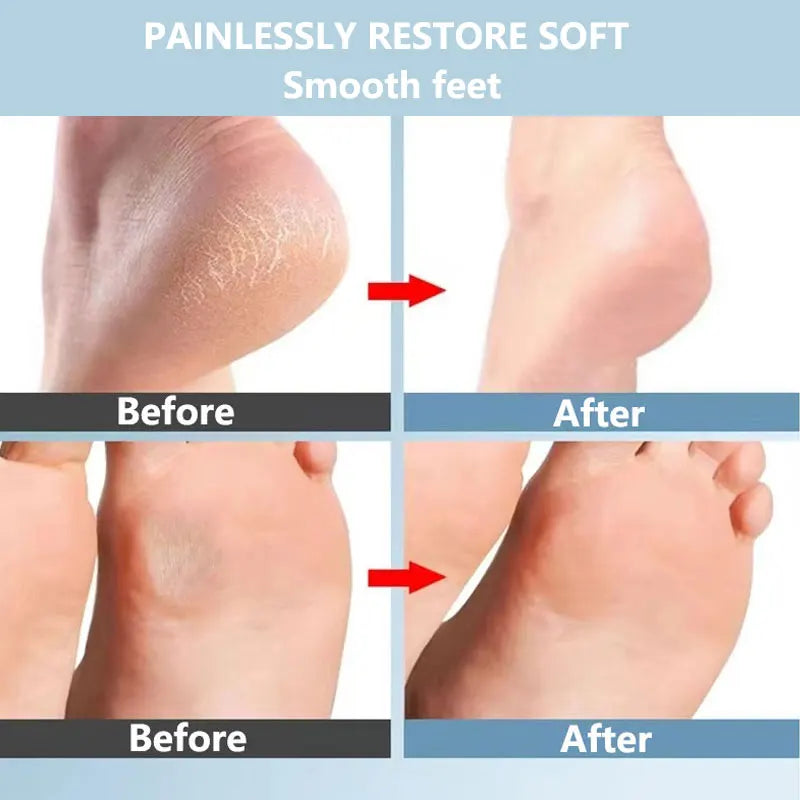 Nano Glass Foot File Callus Remover Heel Scraper in Shower Foot Scrubber Dead Skin Remover Pedicure Foot Buffer for Soft Feet