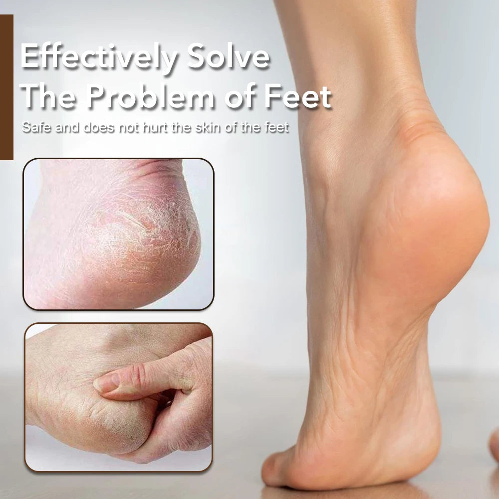 1Pcs Pedicure Tool Rasp Foot File Professional Foot Care Removes Hard Skin Callus Remover Feet Scrubber Wet & Dry Use